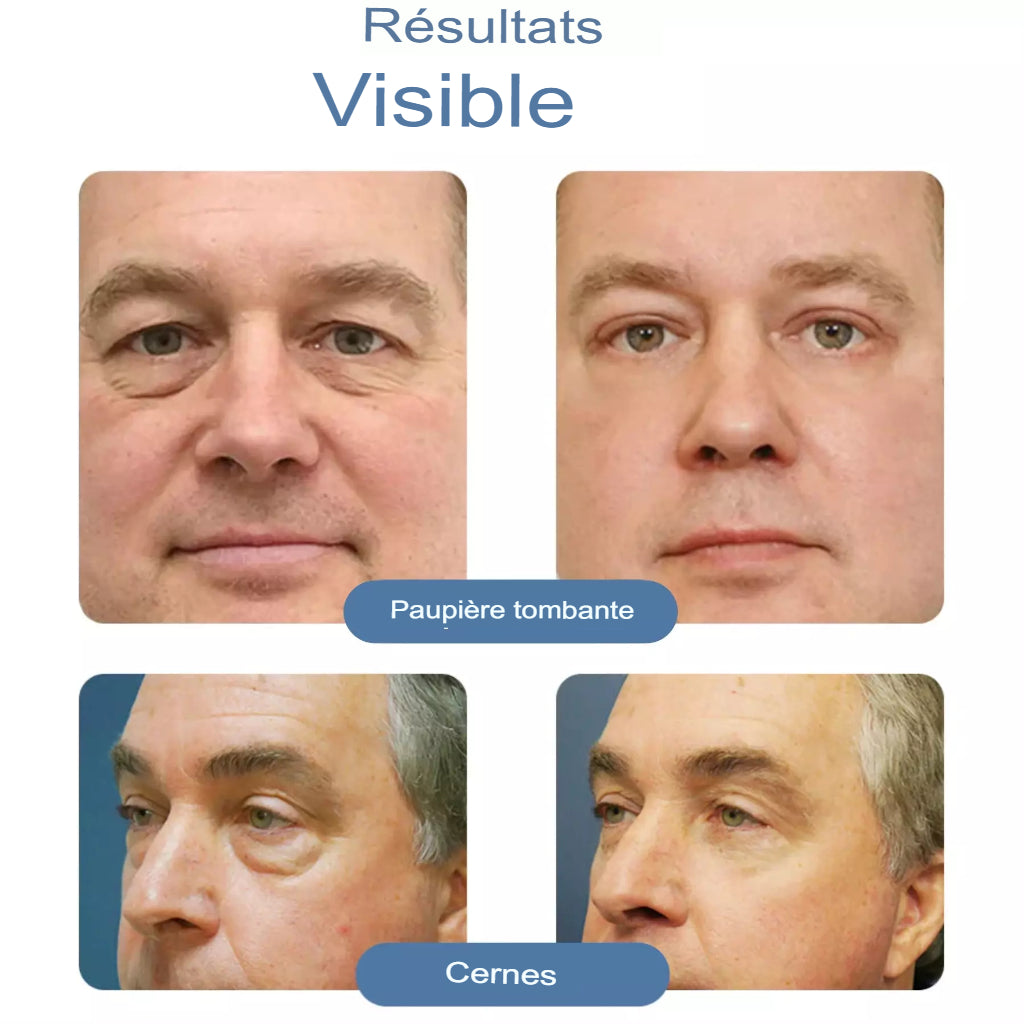 Derma Lift - Paupières fermes et liftées à effet permanent